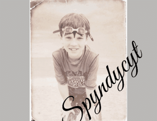 Spyndycyt